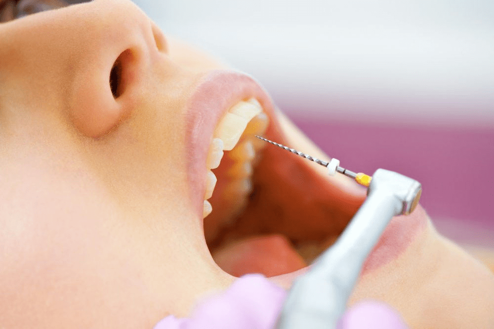 Dentist Marrakech, dental care Marrakech, Dentiste Marrakech