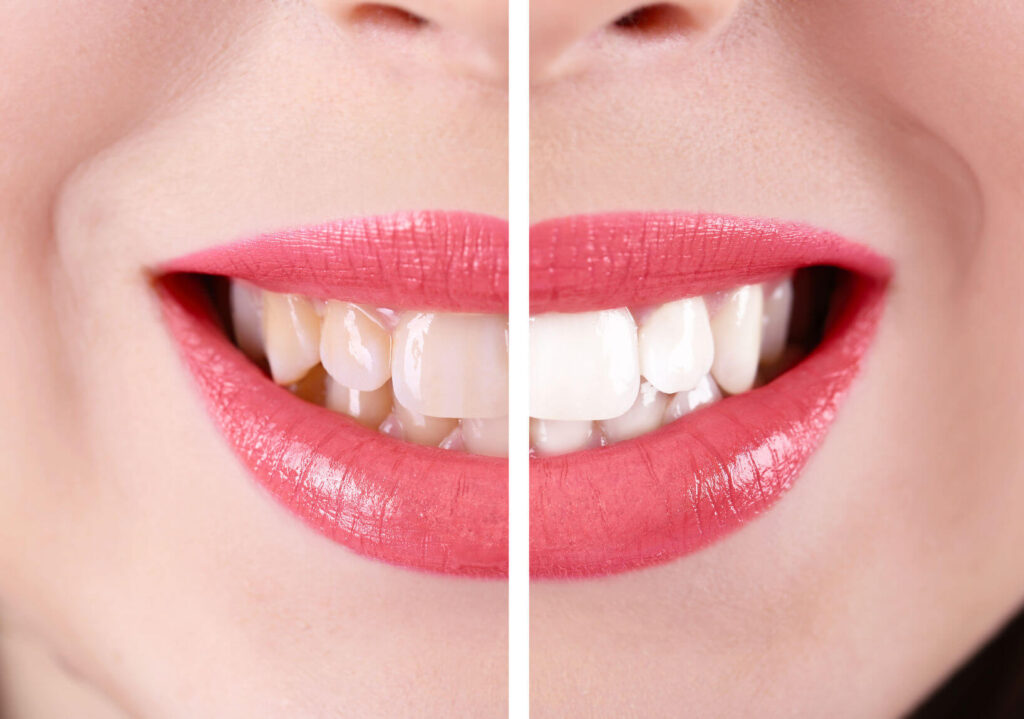 Dentist Marrakech, dental care Marrakech, Dentiste Marrakech