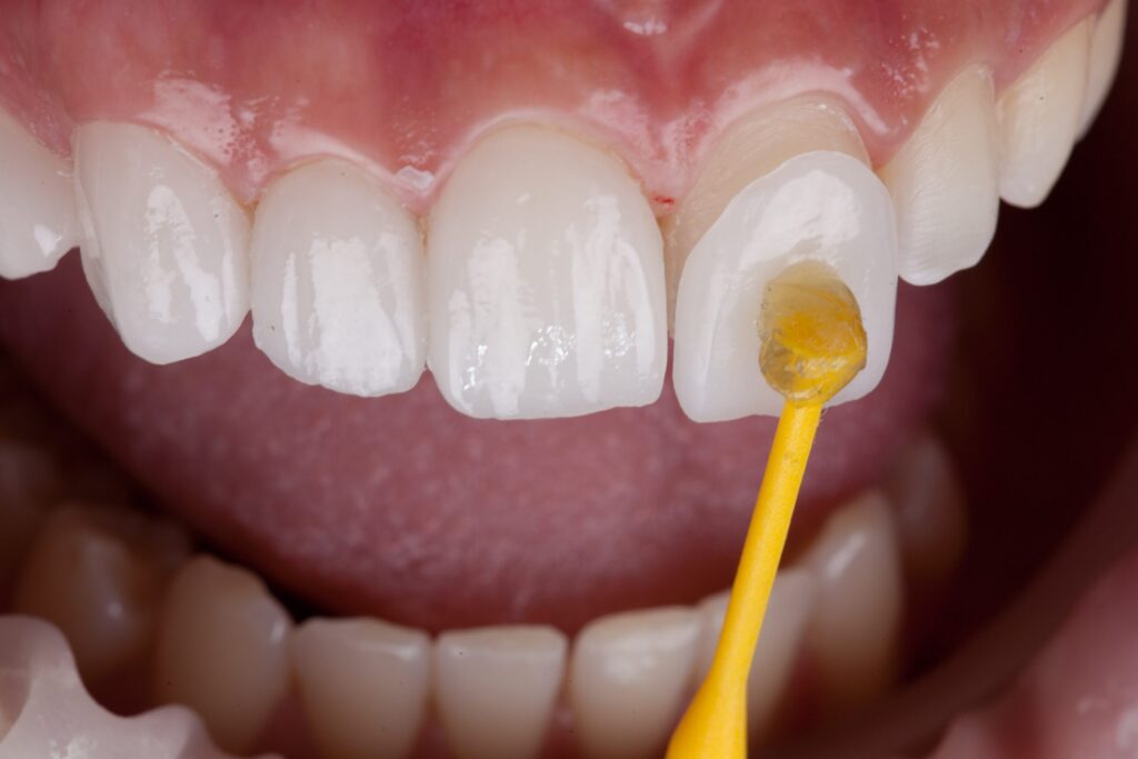 Dentist Marrakech, dental care Marrakech, Dentiste Marrakech
