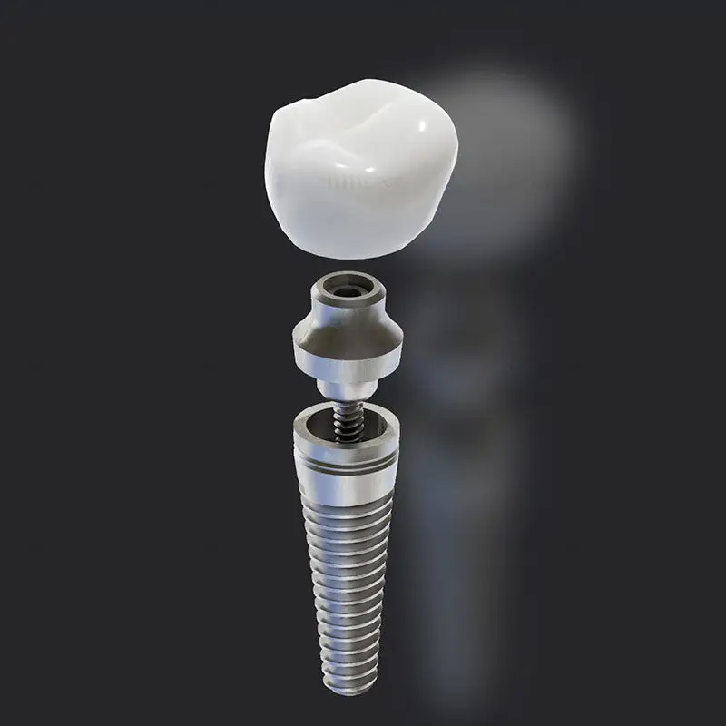 Dentist Marrakech, dental care Marrakech, Dentiste Marrakech