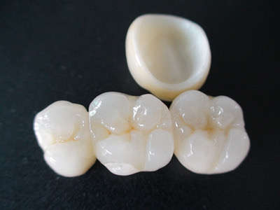 Dentist Marrakech, dental care Marrakech, Dentiste Marrakech